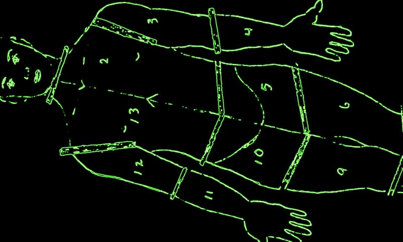 A dismemberment diagram sometimes associated with the Mad Butcher. (Image courtesy Melody Bragg)